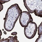 Anti-SDC1 antibody produced in rabbit Prestige Antibodies® Powered by Atlas Antibodies, affinity isolated antibody, buffered aqueous glycerol solution
