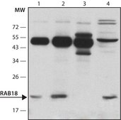 Anti-Rab18 antibody produced in rabbit ~1.0 mg/mL, affinity isolated antibody