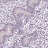 Anti-CAPZA3 antibody produced in rabbit Prestige Antibodies® Powered by Atlas Antibodies, affinity isolated antibody, buffered aqueous glycerol solution