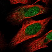Anti-MTF1 antibody produced in rabbit Prestige Antibodies® Powered by Atlas Antibodies, affinity isolated antibody, buffered aqueous glycerol solution