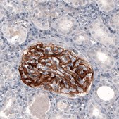 Monoclonal Anti-F3 antibody produced in mouse Prestige Antibodies® Powered by Atlas Antibodies, clone CL3807, purified immunoglobulin, buffered aqueous glycerol solution