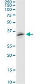 Monoclonal Anti-RNF126 antibody produced in mouse clone 3F11, purified immunoglobulin, buffered aqueous solution