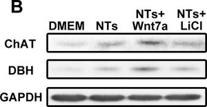 Anti-Choline Acetyltransferase Antibody, clone 1E6 ascites fluid, clone 1E6, Chemicon®