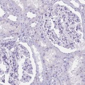 Anti-COLEC12 antibody produced in rabbit Prestige Antibodies® Powered by Atlas Antibodies, affinity isolated antibody, buffered aqueous glycerol solution