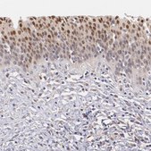 Anti-ATF3 antibody produced in rabbit Prestige Antibodies® Powered by Atlas Antibodies, affinity isolated antibody, buffered aqueous glycerol solution