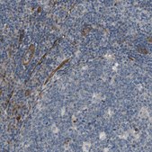 Anti-BVES antibody produced in rabbit Prestige Antibodies® Powered by Atlas Antibodies, affinity isolated antibody, buffered aqueous glycerol solution