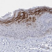 Anti-HORMAD1 antibody produced in rabbit Prestige Antibodies® Powered by Atlas Antibodies, affinity isolated antibody, buffered aqueous glycerol solution