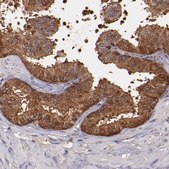 Anti-WASHC1 antibody produced in rabbit Prestige Antibodies® Powered by Atlas Antibodies, affinity isolated antibody, buffered aqueous glycerol solution