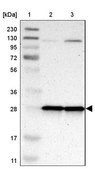 Anti-MRPL9 antibody produced in rabbit Prestige Antibodies® Powered by Atlas Antibodies, affinity isolated antibody, buffered aqueous glycerol solution