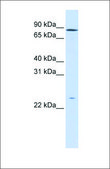 Anti-GPSM2 antibody produced in rabbit affinity isolated antibody