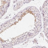 Anti-CAPZA3 antibody produced in rabbit Prestige Antibodies® Powered by Atlas Antibodies, affinity isolated antibody, buffered aqueous glycerol solution
