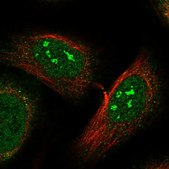 Anti-N4BP1 antibody produced in rabbit Prestige Antibodies® Powered by Atlas Antibodies, affinity isolated antibody, buffered aqueous glycerol solution