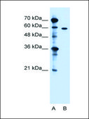 Anti-ZDHHC13 antibody produced in rabbit IgG fraction of antiserum