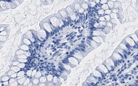 Anti-Interferon β Antibody, clone 4F5 ZooMAb® Rabbit Monoclonal recombinant, expressed in HEK 293 cells