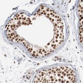 Anti-BUB3 antibody produced in rabbit Prestige Antibodies® Powered by Atlas Antibodies, affinity isolated antibody, buffered aqueous glycerol solution