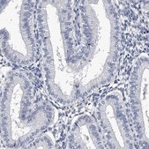 Anti-CRISP2 antibody produced in rabbit Prestige Antibodies® Powered by Atlas Antibodies, affinity isolated antibody, buffered aqueous glycerol solution