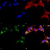 Monoclonal Anti-GABRB3 antibody produced in mouse clone S87-25, 1 mg/mL, purified immunoglobulin
