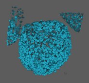 BCH245 Human H3K27M Glioma Cell Line