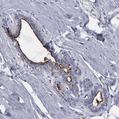 Anti-TM4SF1 antibody produced in rabbit Prestige Antibodies® Powered by Atlas Antibodies, affinity isolated antibody, buffered aqueous glycerol solution