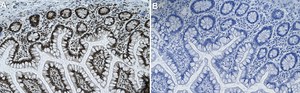 Anti-PTBP1/PTB Antibody, clone 1G23 ZooMAb® Rabbit Monoclonal recombinant, expressed in HEK 293 cells