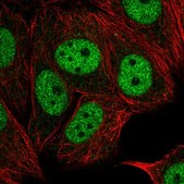 Anti-TAF6L antibody produced in rabbit Prestige Antibodies® Powered by Atlas Antibodies, affinity isolated antibody, buffered aqueous glycerol solution