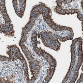 Anti-TOMM22 antibody produced in rabbit affinity isolated antibody, buffered aqueous glycerol solution