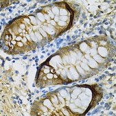 Anti-SELENBP1 antibody produced in rabbit