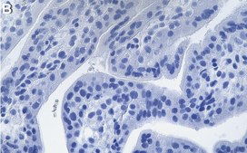 Anti-CD46 Antibody, clone 1C10 ZooMAb® Rabbit Monoclonal recombinant, expressed in HEK 293 cells
