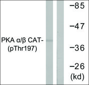 Anti-phospho-PKA α/β CAT (pThr197) antibody produced in rabbit affinity isolated antibody