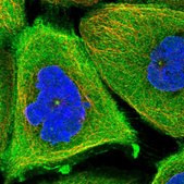 Anti-TCHP antibody produced in rabbit affinity isolated antibody, buffered aqueous glycerol solution
