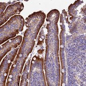 Anti-NOD2 antibody produced in rabbit Prestige Antibodies® Powered by Atlas Antibodies, affinity isolated antibody, buffered aqueous glycerol solution