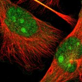 Anti-TAOK2 antibody produced in rabbit Prestige Antibodies® Powered by Atlas Antibodies, affinity isolated antibody, buffered aqueous glycerol solution