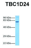 Anti-TBC1D24 antibody produced in rabbit affinity isolated antibody