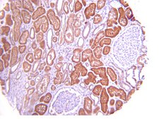 Anti-PI3 Kinase Antibody, p110α from rabbit, purified by affinity chromatography