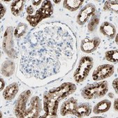 Anti-TSPAN1 antibody produced in rabbit Prestige Antibodies® Powered by Atlas Antibodies, affinity isolated antibody, buffered aqueous glycerol solution