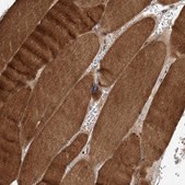 Anti-FBXW8 antibody produced in rabbit Prestige Antibodies® Powered by Atlas Antibodies, affinity isolated antibody, buffered aqueous glycerol solution