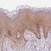 Anti-FBXL14 antibody produced in rabbit Prestige Antibodies® Powered by Atlas Antibodies, affinity isolated antibody, buffered aqueous glycerol solution