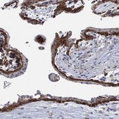 Anti-MPP1 antibody produced in rabbit Prestige Antibodies® Powered by Atlas Antibodies, affinity isolated antibody, buffered aqueous glycerol solution