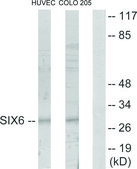 Anti-SIX6 antibody produced in rabbit affinity isolated antibody