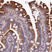 Anti-LSM4 antibody produced in rabbit affinity isolated antibody, buffered aqueous glycerol solution