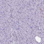 Anti-PITPNM3 antibody produced in rabbit Prestige Antibodies® Powered by Atlas Antibodies, affinity isolated antibody, buffered aqueous glycerol solution