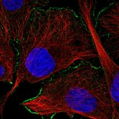 Anti-CAMK2A antibody produced in rabbit Prestige Antibodies® Powered by Atlas Antibodies, affinity isolated antibody, buffered aqueous glycerol solution