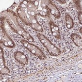 Anti-SRSF2 antibody produced in rabbit Prestige Antibodies® Powered by Atlas Antibodies, affinity isolated antibody, buffered aqueous glycerol solution