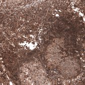 Anti-TRIM21 antibody produced in rabbit Prestige Antibodies® Powered by Atlas Antibodies, affinity isolated antibody, buffered aqueous glycerol solution