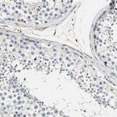 Anti-CAPN1 antibody produced in rabbit Prestige Antibodies® Powered by Atlas Antibodies, affinity isolated antibody, buffered aqueous glycerol solution