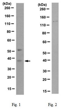 Anti-SSTR5/SS5R (P335L mutation) Antibody, clone D2F2 clone D2F2, from mouse
