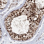 Anti-GPATCH11 antibody produced in rabbit Prestige Antibodies® Powered by Atlas Antibodies, affinity isolated antibody, buffered aqueous glycerol solution