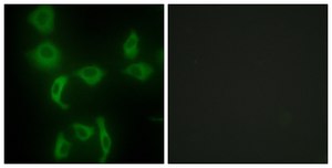 Anti-IARS2 antibody produced in rabbit affinity isolated antibody