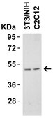 Anti-DR5 Antibody, CT Chemicon®, from rabbit