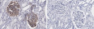 Anti-Vimentin Antibody, clone 2I13 ZooMAb® Rabbit Monoclonal recombinant, expressed in HEK 293 cells